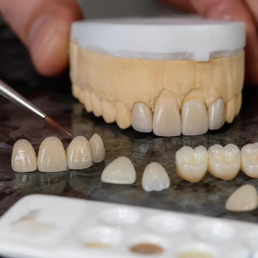 Smile Makeover clinical detail